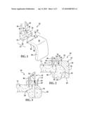 Patient Specific Alignment Guide With Cutting Surface and Laser Indicator diagram and image