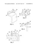 Patient Specific Alignment Guide With Cutting Surface and Laser Indicator diagram and image