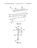 Patient Specific Alignment Guide With Cutting Surface and Laser Indicator diagram and image