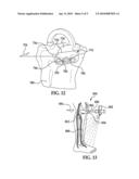 Patient Specific Alignment Guide With Cutting Surface and Laser Indicator diagram and image