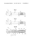 ELONGATED IMPLANT DEVICE AND BONE STABILIZATION DEVICE INCLUDING THE SAME diagram and image