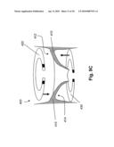 SYSTEMS AND METHODS FOR VALVE ANNULUS REMODELING diagram and image