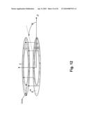 SYSTEMS AND METHODS FOR VALVE ANNULUS REMODELING diagram and image