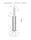 SYSTEMS AND METHODS FOR VALVE ANNULUS REMODELING diagram and image