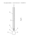 SYSTEMS AND METHODS FOR VALVE ANNULUS REMODELING diagram and image