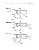 RESPIRATORY SECRETION RETENTION DEVICE, SYSTEM AND METHOD diagram and image