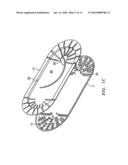 SUTURE PACKAGING diagram and image