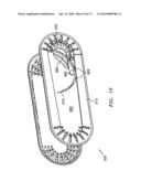 SUTURE PACKAGING diagram and image