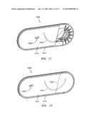 SUTURE PACKAGING diagram and image