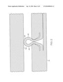 EXPANDABLE METAL-TO-METAL SEAL diagram and image