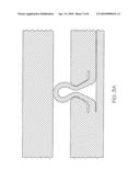 EXPANDABLE METAL-TO-METAL SEAL diagram and image