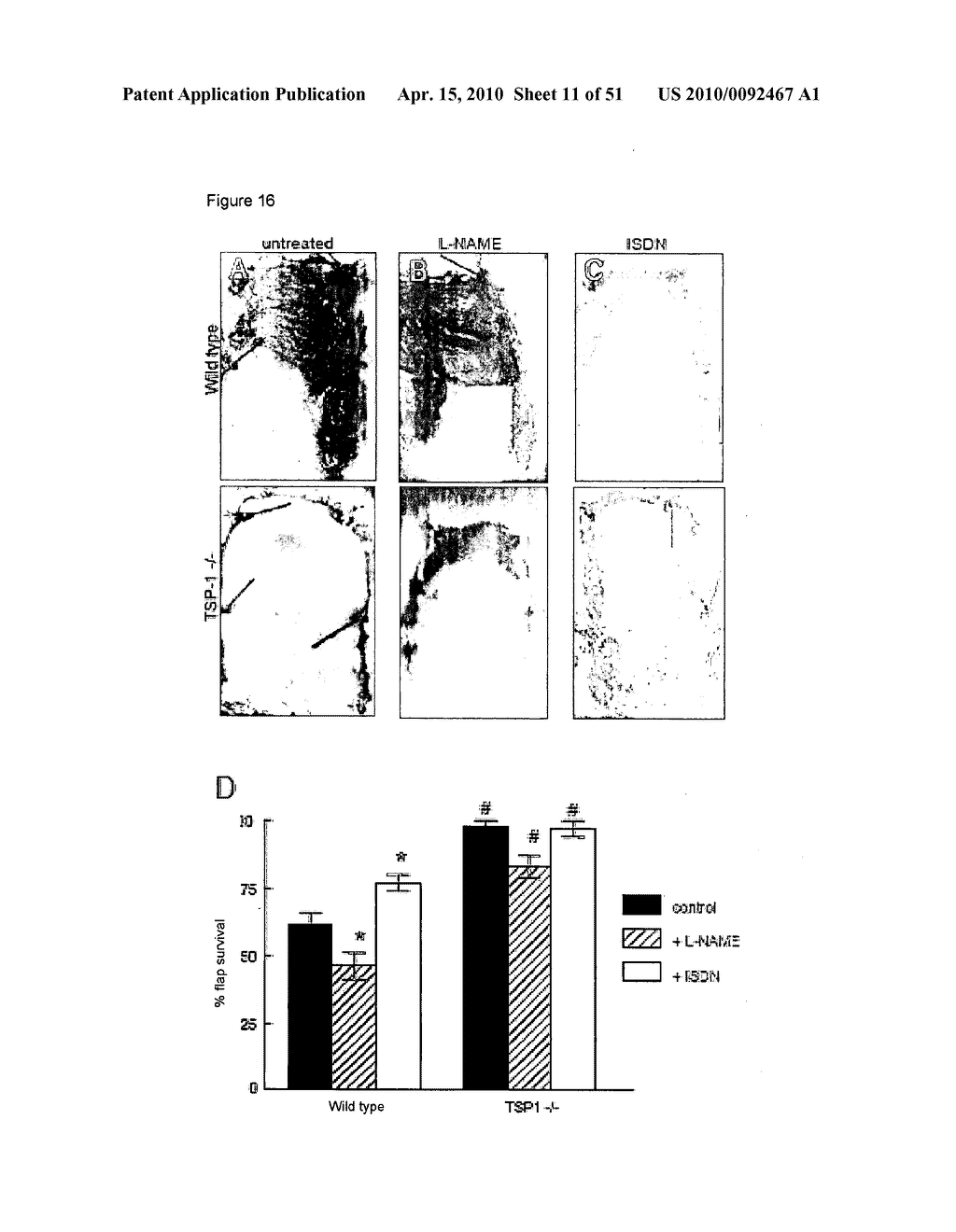 PREVENTION OF TISSUE ISCHEMIA, RELATED METHODS AND COMPOSITIONS - diagram, schematic, and image 12