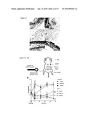 PREVENTION OF TISSUE ISCHEMIA, RELATED METHODS AND COMPOSITIONS diagram and image