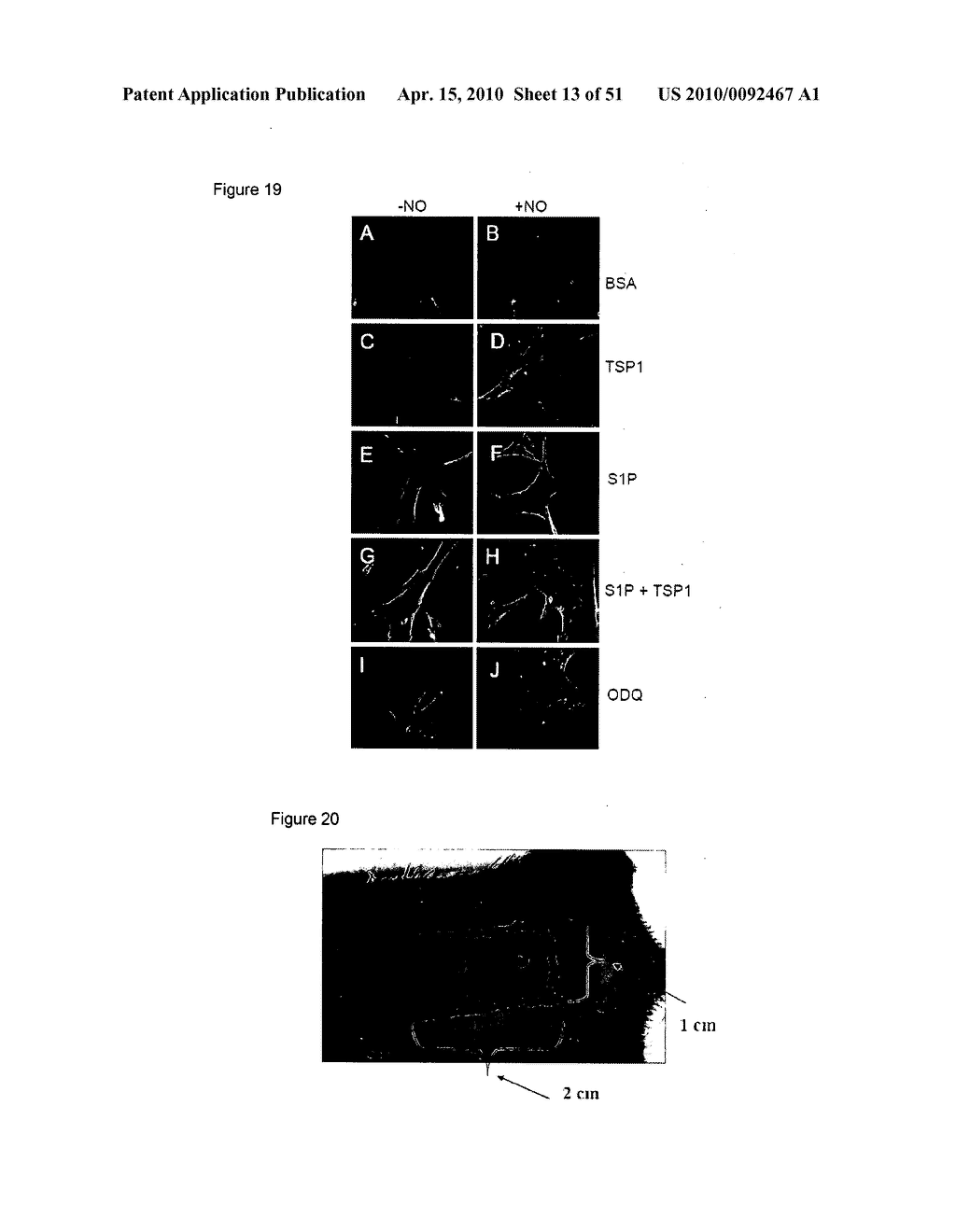 PREVENTION OF TISSUE ISCHEMIA, RELATED METHODS AND COMPOSITIONS - diagram, schematic, and image 14