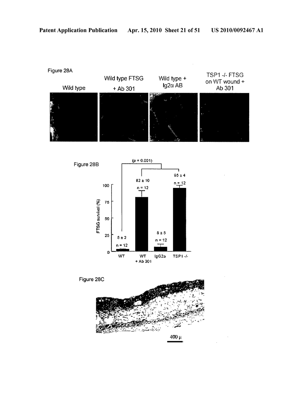 PREVENTION OF TISSUE ISCHEMIA, RELATED METHODS AND COMPOSITIONS - diagram, schematic, and image 22