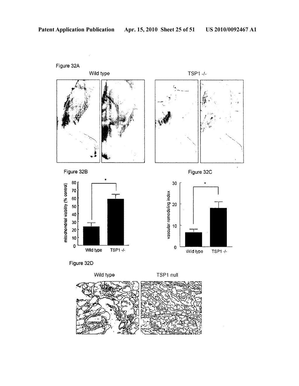 PREVENTION OF TISSUE ISCHEMIA, RELATED METHODS AND COMPOSITIONS - diagram, schematic, and image 26