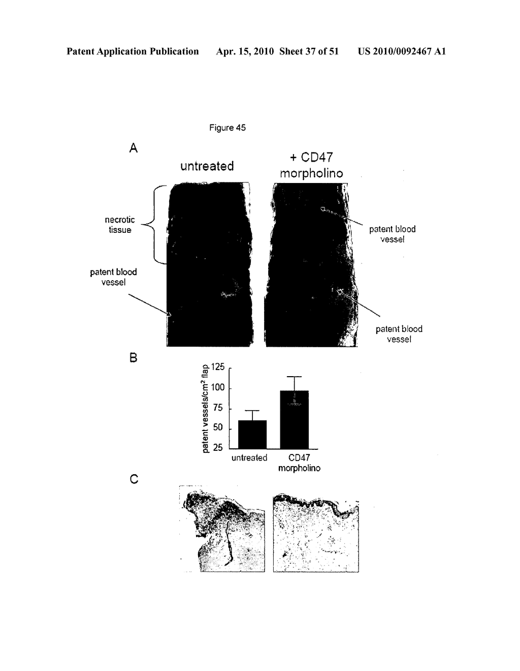 PREVENTION OF TISSUE ISCHEMIA, RELATED METHODS AND COMPOSITIONS - diagram, schematic, and image 38