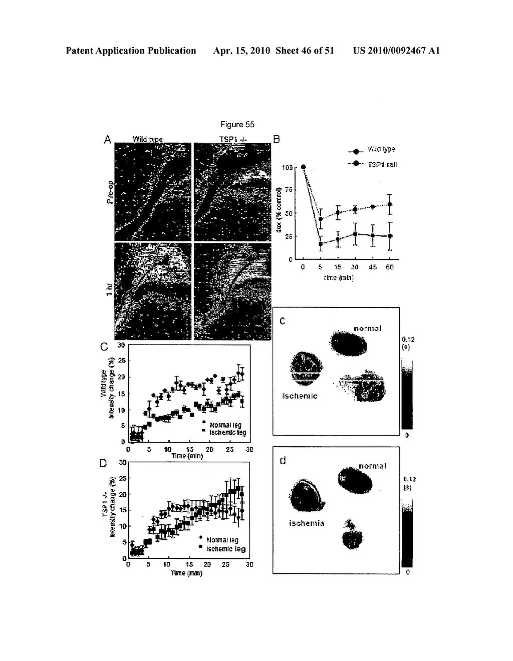 PREVENTION OF TISSUE ISCHEMIA, RELATED METHODS AND COMPOSITIONS - diagram, schematic, and image 47