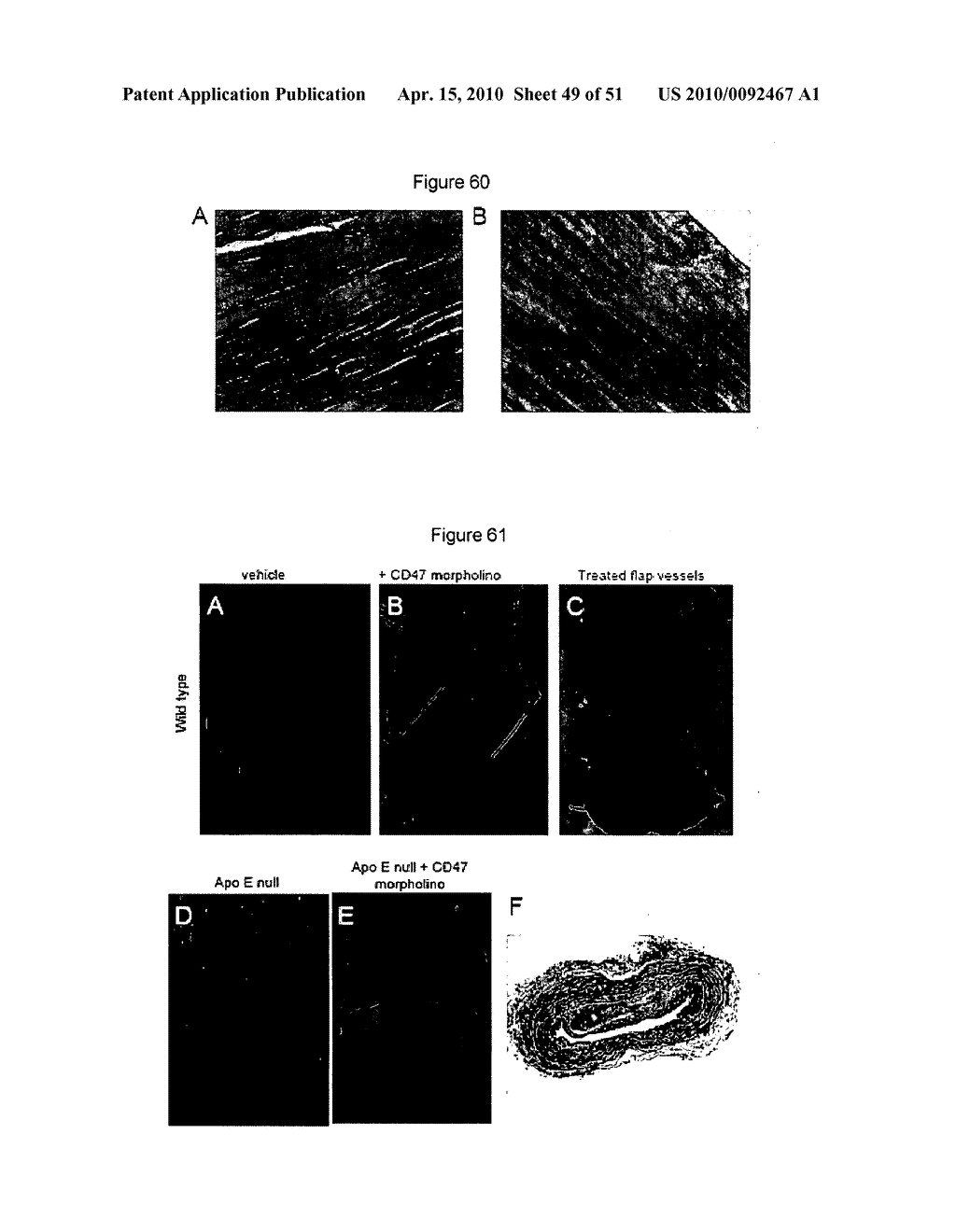 PREVENTION OF TISSUE ISCHEMIA, RELATED METHODS AND COMPOSITIONS - diagram, schematic, and image 50