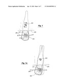 ORTHODONTIC POWER ARM diagram and image