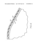 HIGH PERFORMANCE BALLOON CATHETER/COMPONENT diagram and image