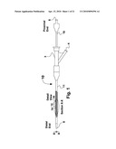 RECONSTRAINABLE STENT DELIVERY SYSTEM diagram and image