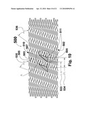 RECONSTRAINABLE STENT DELIVERY SYSTEM diagram and image