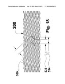 RECONSTRAINABLE STENT DELIVERY SYSTEM diagram and image