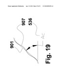 RECONSTRAINABLE STENT DELIVERY SYSTEM diagram and image