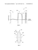 Multifocal Intraocular Lens diagram and image