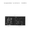 Autologous dental pulp stem cell-based bone graft substitute diagram and image