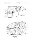 MUSCULOSKELETAL REPOSITIONING DEVICE diagram and image