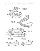 MUSCULOSKELETAL REPOSITIONING DEVICE diagram and image