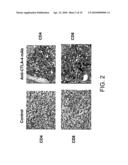 BIOMARKERS AND METHODS FOR DETERMINING SENSITIVITY TO CTLA-4 ANTAGONISTS diagram and image