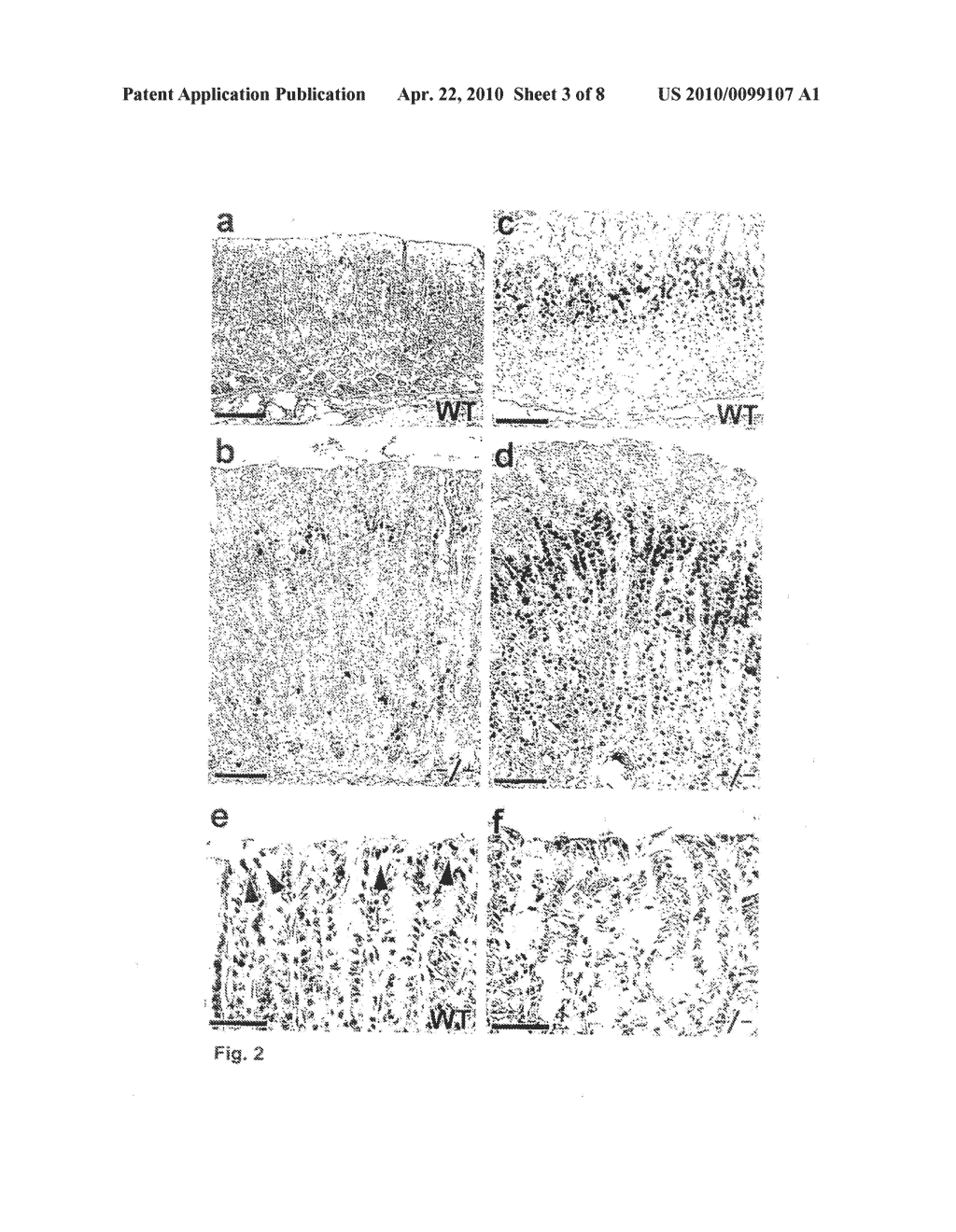 METHOD FOR IDENTIFYING AN INTESTINAL PHENOTYPE - diagram, schematic, and image 04