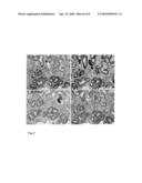 METHOD FOR IDENTIFYING AN INTESTINAL PHENOTYPE diagram and image