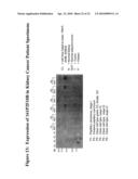 ANTIBODIES AGAINST A PROTEIN ENTITLED 161P2F10B diagram and image