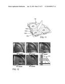 Direct Antimicrobial Susceptibility Assay diagram and image