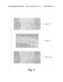 Method of treating diabetes-related vascular complications diagram and image