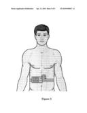 DEVICE FOR THE REMOVAL OF TOXIC SUBSTANCES FROM BLOOD diagram and image