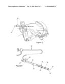 Cannulated apertured grooved director diagram and image