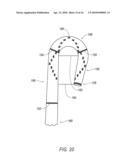 Devices for Superficial Femoral Artery Intervention diagram and image