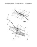 CATHETER AND SEAL ASSEMBLY diagram and image