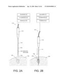 TISSUE ABLATION METHODS diagram and image