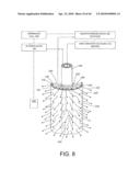 TISSUE ABLATION METHODS diagram and image