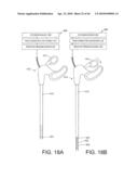 TISSUE ABLATION METHODS diagram and image