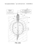 TISSUE ABLATION METHODS diagram and image