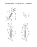 INSTRUMENTS FOR PREPARING BONE IMPLANTS diagram and image