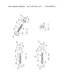 INSTRUMENTS FOR PREPARING BONE IMPLANTS diagram and image