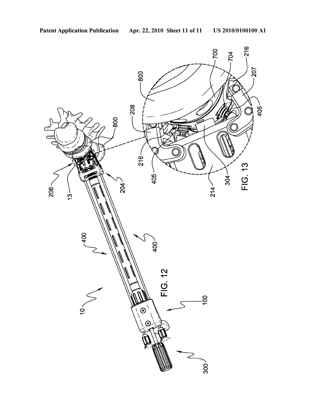 SURGICAL INSTRUMENT AND METHOD OF USE FOR INSERTING AN IMPLANT BETWEEN TWO BONES - diagram, schematic, and image 12